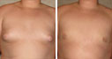 Before & After Photos